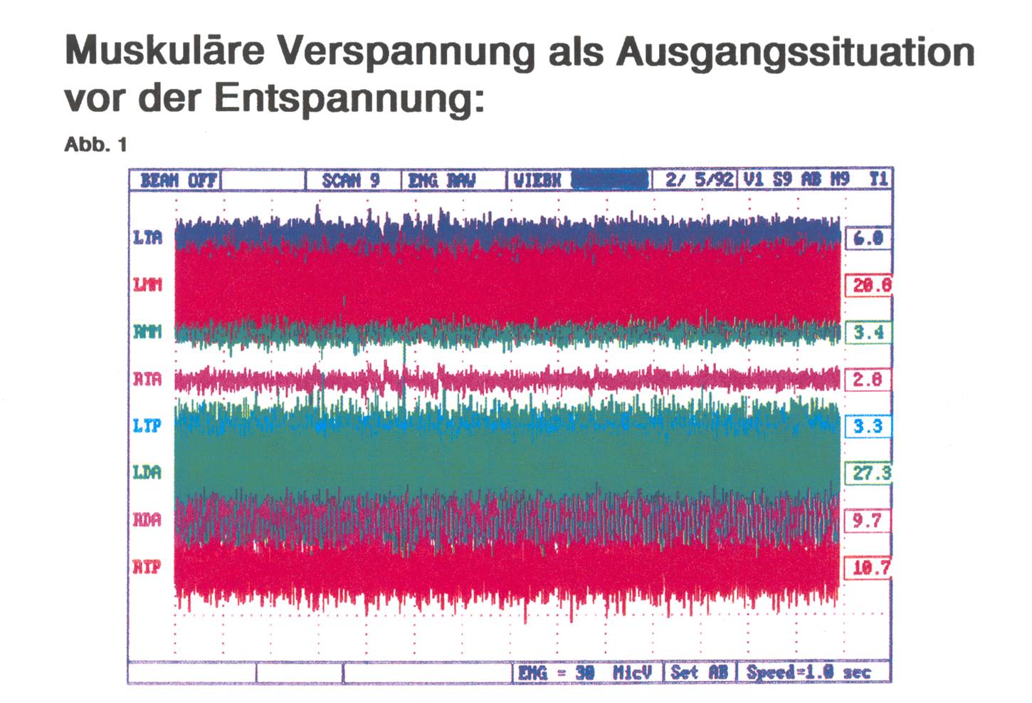 Myo-verspannt